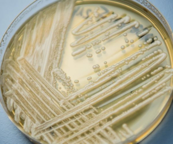 Washington faces first outbreak of Candida auris fungal infections